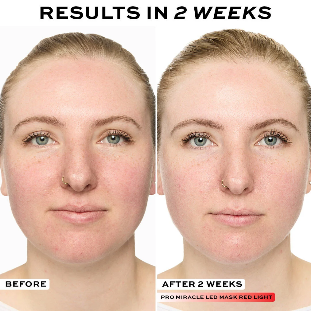 Makeup Revolution Revolution Pro Miracle LED Face Mask