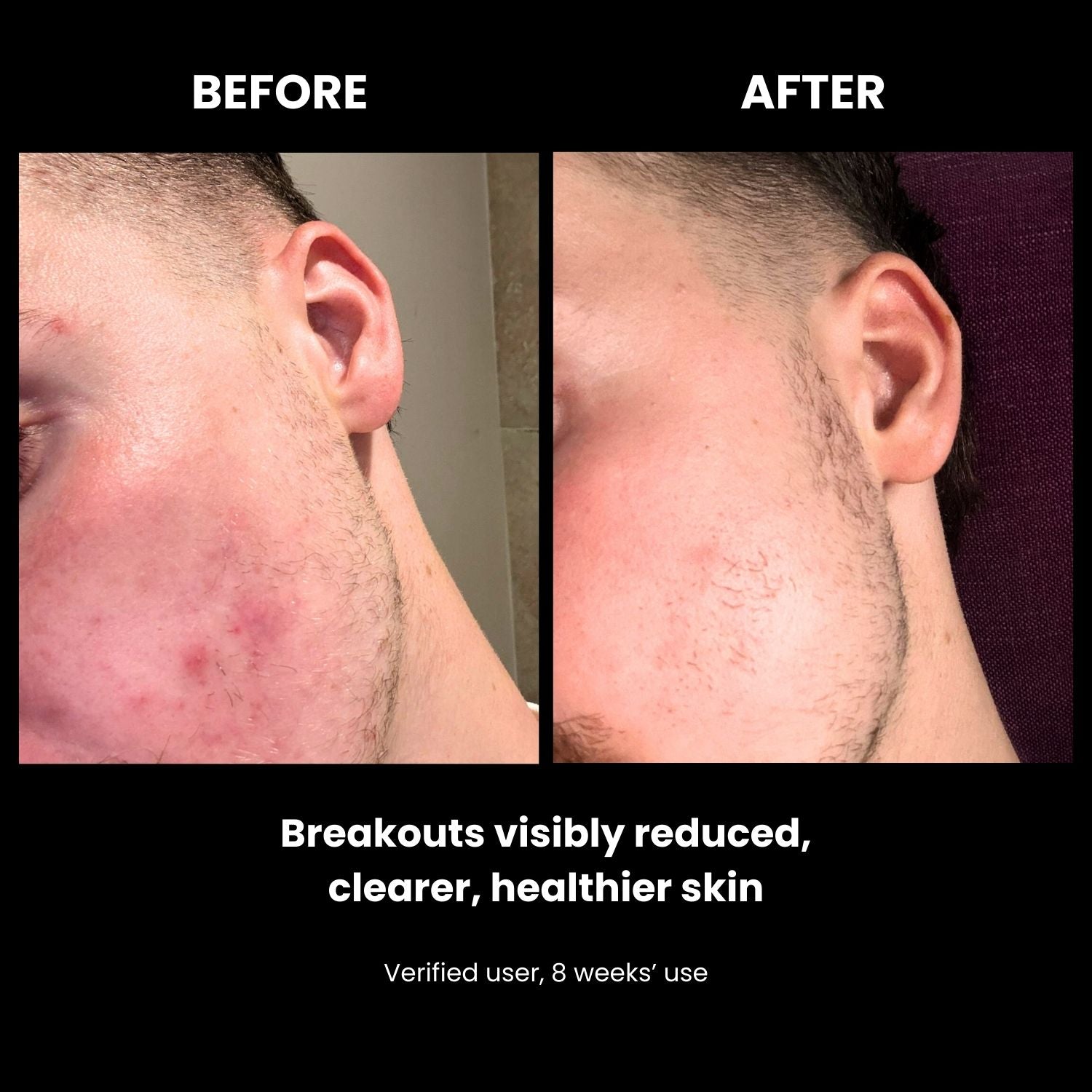 LUSTRE RENEW PRO FACEWEAR