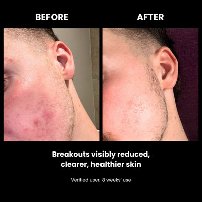 LUSTRE RENEW PRO FACEWEAR