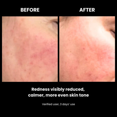 LUSTRE RENEW PRO FACEWEAR