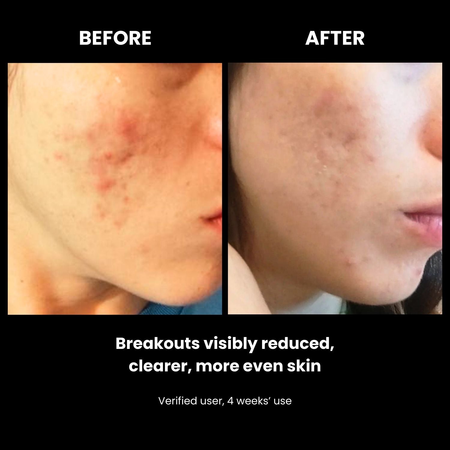 LUSTRE REVIVE LED Mask