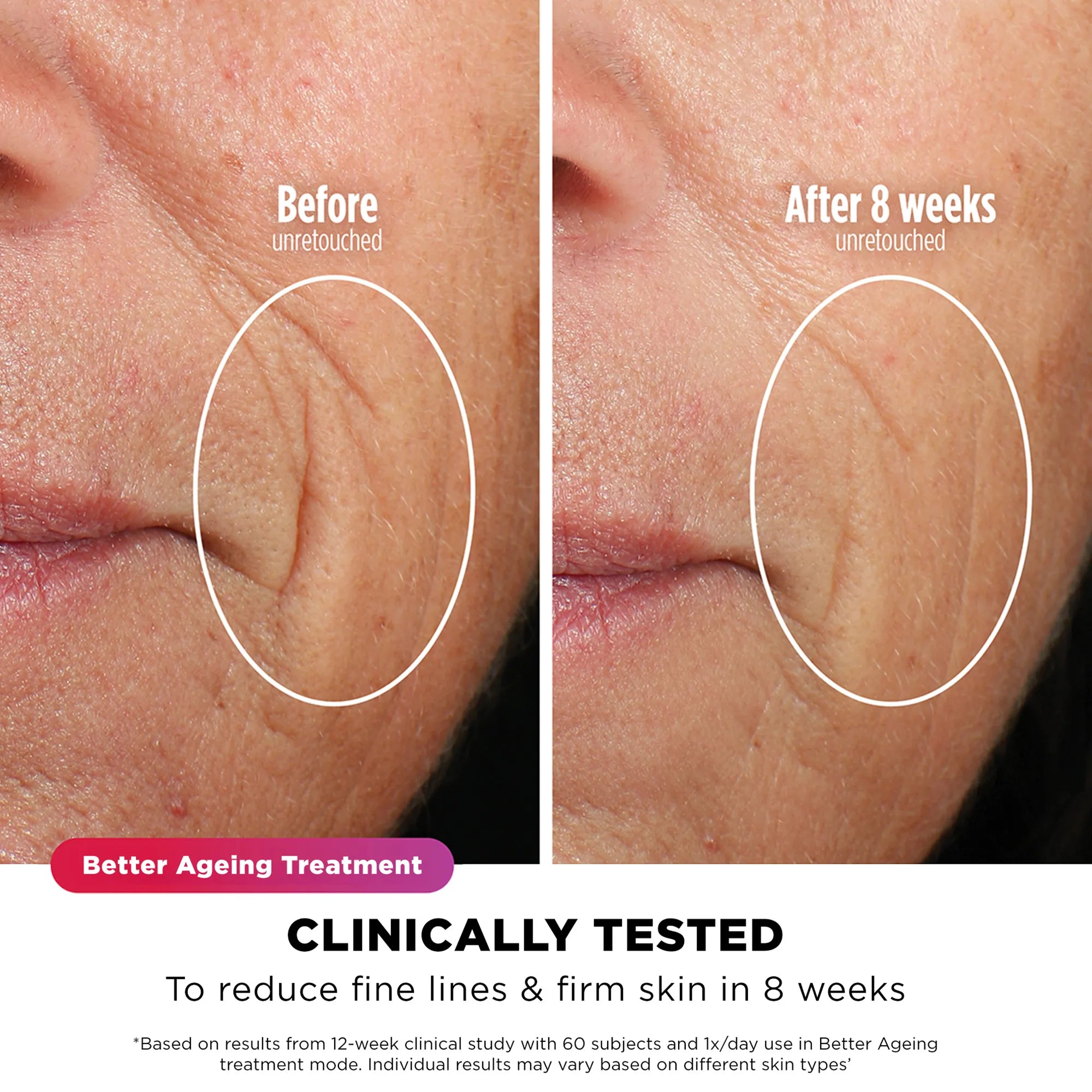 Shark CryoGlow Under-Eye Cooling + LED Face Mask