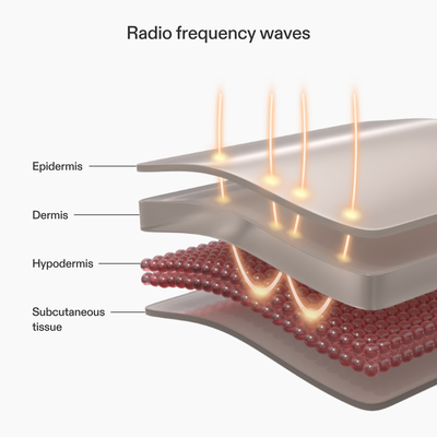 CurrentBody Skin RF Radio Frequency Skin Tightening Device
