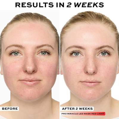 Makeup Revolution Revolution Pro Miracle LED Face Mask
